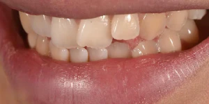 Your Perfect Smile Starts Here